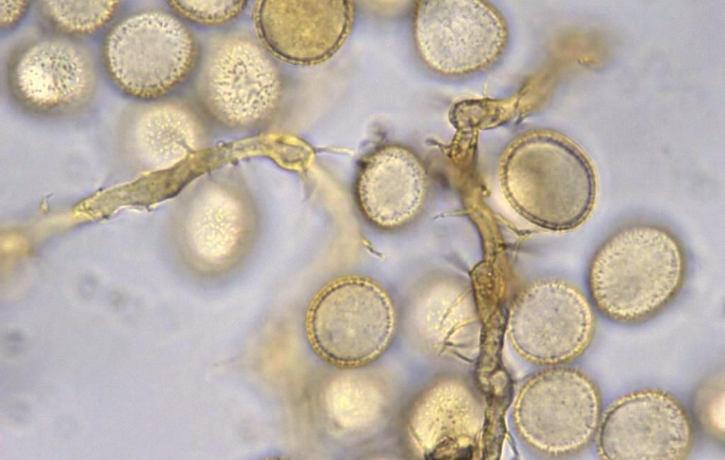 Perichaena chrysosperma